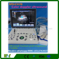 2016 La mayoría de los usados ​​portátil de color doppler ultrasonido máquina MSLCU26i para OB, GYN, vascular, examen transvaginal